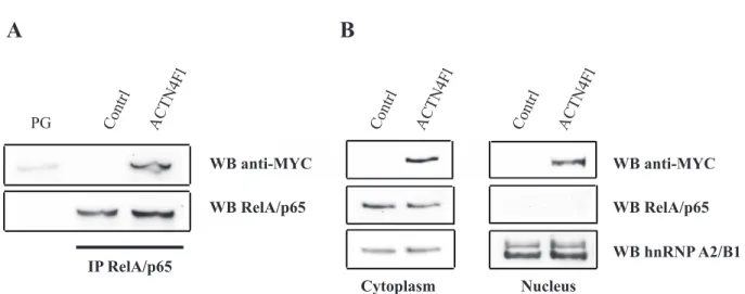 Figure 1: Over-expressed ACTN4 co-immunoprecipitates with RelA/p65 in the cytoplasm of HEK293T cells but does  not mediate RelA/p65 nuclear translocation
