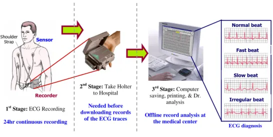 Figure 8. Current methods to record ECG data for long number of hours and then carrying the recorded data to  the healthcare center for printing and analysis