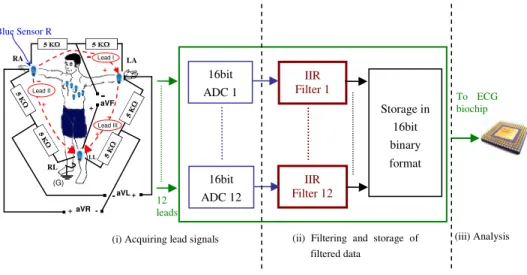 Figure 13. The system for sensing and filtering of ECG lead signals before sending data to the ECG biochip for  analysis