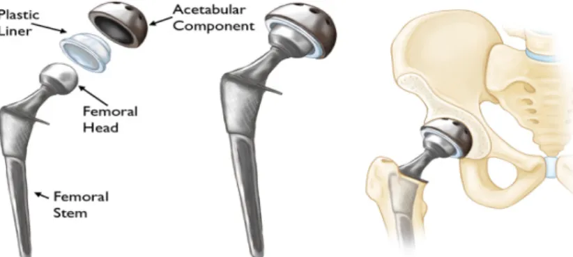 Figure	 1: 	 Illustration	 of	 the	 hip	 joint	 as	 it	 functions	 as	 a	 fulcrum	 balancing	 the	 force	 of	 body	 weight	with	the	force	generated	by	the	hip	abductors