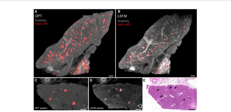 FIGURE 2 | Optical projection tomography (OPT) and light sheet ﬂuorescence microscopy (LSFM) imaging of human islets of Langerhans based on islet