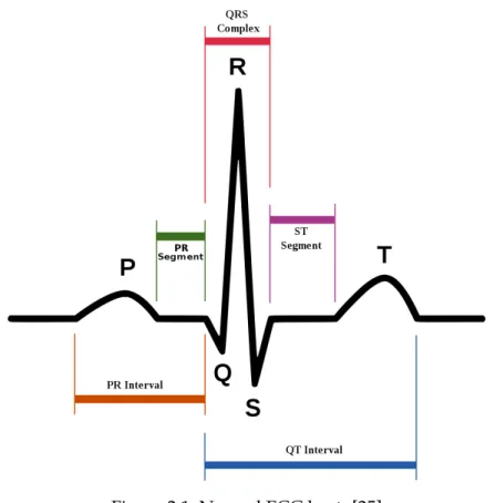 Figure 2.1: Normal ECG beat. [25]