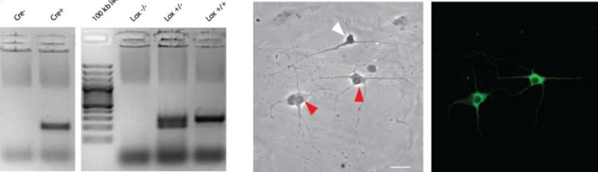 Figure  3  Mesencephalic  neuron  culture  on  a  glass  coverslip  immunostained  for  TH