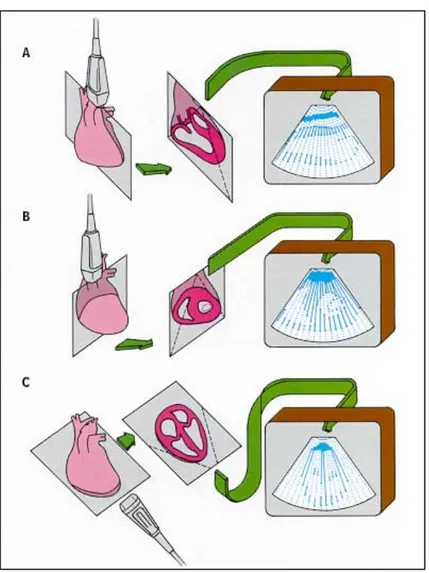 Figure 2.5: Three different positions to view the heart from with echocardiography