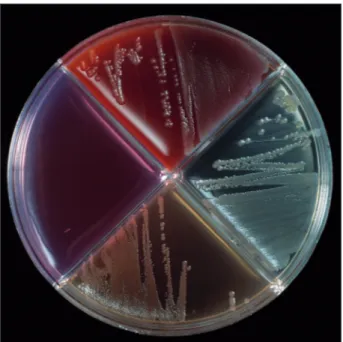 Figure 38.6. Blood agar with Salmonella Dublin growth. Salmonella is a  bacterium  which  epidemiology  can  change  as  a  response  to  climate  change