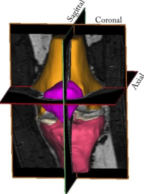 Figure 2.2: The knee joint depicted from the anterior side with the three orthogonal imaging planes market out.