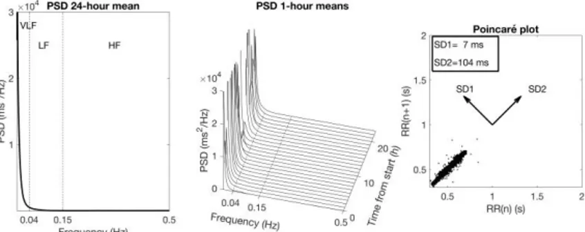 Figure 7. Examples of low HRV 