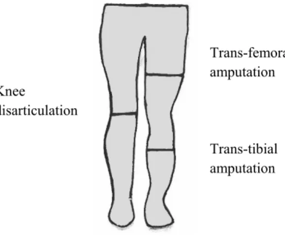 Figure 2. Amputation levels. 