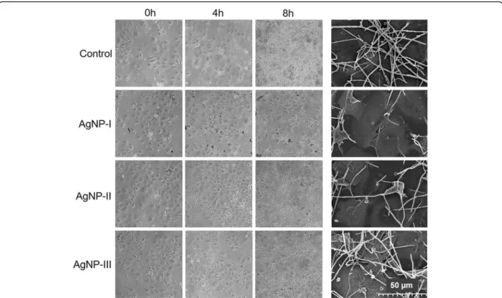 Fig. 5 Size-dependent modulation of the morphological switch of opportunistic pathogenic yeasts co-cultured with keratinocytes by AgNPs.