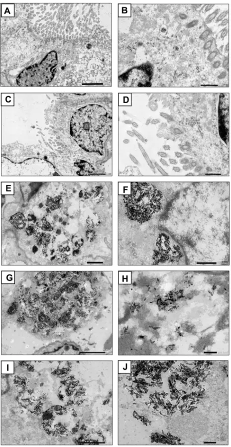 Figure 3 Transmission electron micrographs of lung sections from group C ((A) 5000×, scale bar 2 μm; (B) 15,000×, scale bar 500 nm); VT ((C) 4000×, scale bar 2 μm; (D)  12,000×, scale bar 500 nm); LD ((E) 5000×, scale bar 1 μm; (F) 12,000×, scale bar 500 n