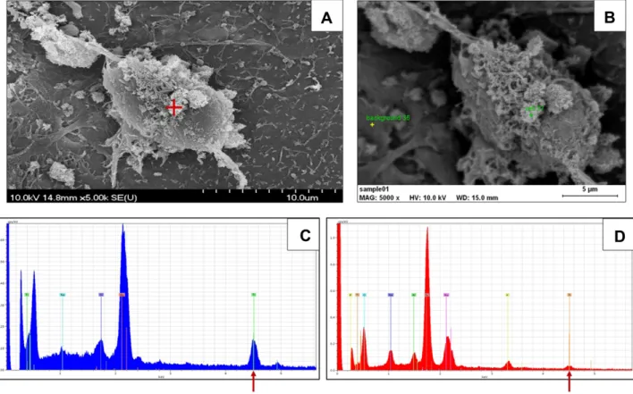 Figure 1 Presence of titanium in treated astrocytes. (A) Scanning electron micrograph of an astrocyte with cell-attached NPs (red cross)