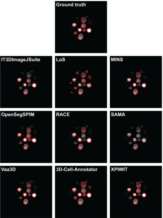 Fig. 2. A representative section of the segmentation masks obtained on the Neurosphere dataset.