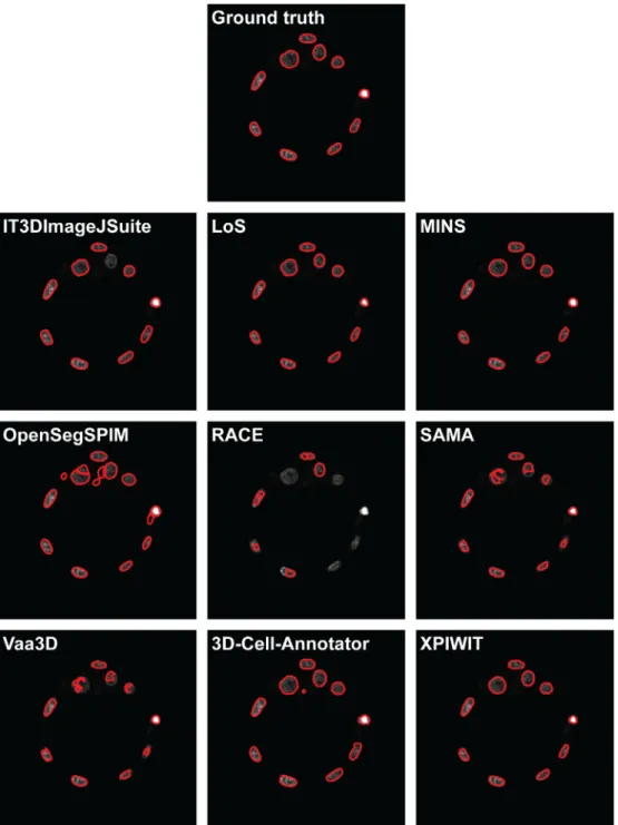 Fig. 2 and Fig. 3 show a representative section of the segmenta- segmenta-tion masks obtained by each tested tool on the Neurosphere and Embryo datasets, respectively