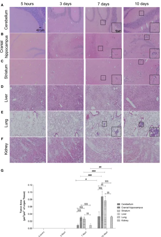 Fig. 1. Profile of breast cancer metastases in the brain and peripheral organs. Hematoxylin – eosin staining of cerebellum (A), cranial hippocampus (B), striatum (C), liver (D), lung (E), and kidney (F) was performed, and the tumor area was quantified (G) 
