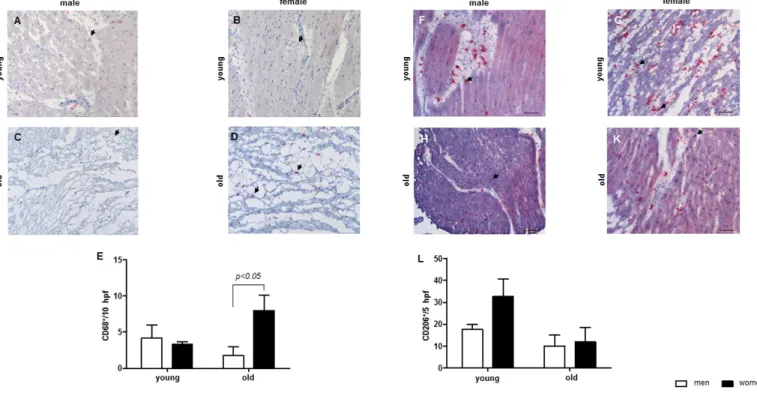 Figure 3. Aging  effect on  the number  of macrophages in cardiac tissue.  Representative  images of cardiac cryosections stained with  antibodies  against  (A‐D)  CD68, followed  by  (E)  statistical  analysis  of CD68‐positive  cells  per  high  power  f