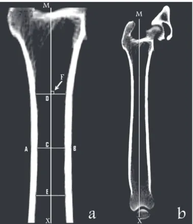 Fig. 3. Frontal plane view of the femur where (a) is a high resolution of the proximal region and (b)  is an image of the complete femur