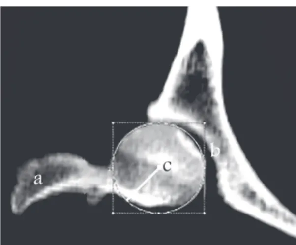 Fig. 5. Frontal plane view of the proximal femur: (a) great trochanter, (b) acetabular cavity,   (c) centre of the femoral head 