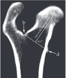 Fig. 6. Frontal plane view of the femur: (a) great trochanter, (b) deepest point of the trochanteric  fossa, (c) centre of the femoral head, (d) lesser trochanter