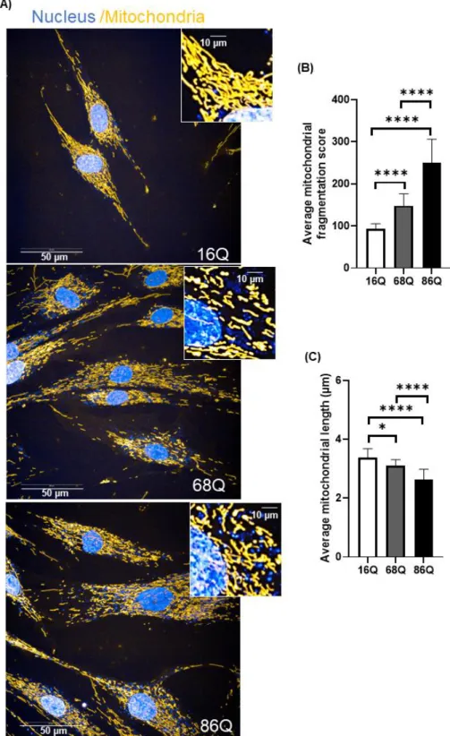Figure 5. Increased mitochondrial fragmentation and reduced mitochondrial length in juvenile HD fibroblasts are not associated with reduced viability