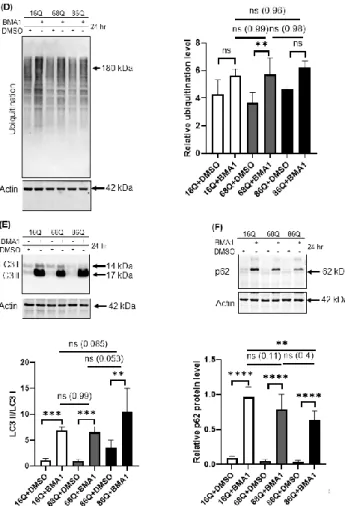 Figure  6. Proteolytic  activity  and  ubiquitination  in  HD  and  healthy  fibroblasts