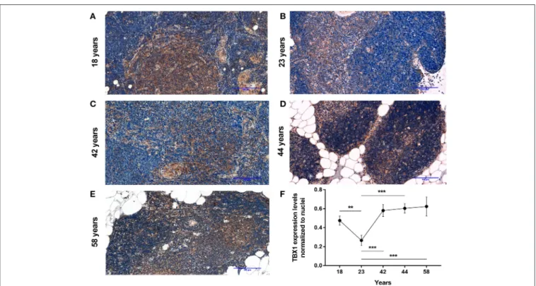 FIGURE 1 | Kinetics of TBX-1 expression in the adult human thymus with age. Human thymic FFPE sections from different ages (18, 23, 42, 44, and 58 years) were evaluated by immune-histochemical staining (A–E), respectively