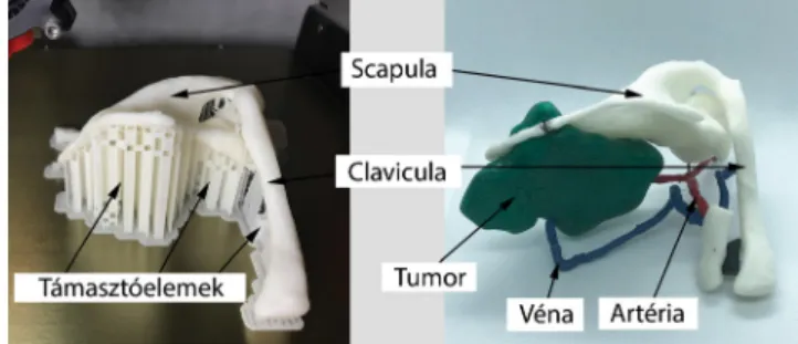 5. ábra A 3D nyomtatás lépései