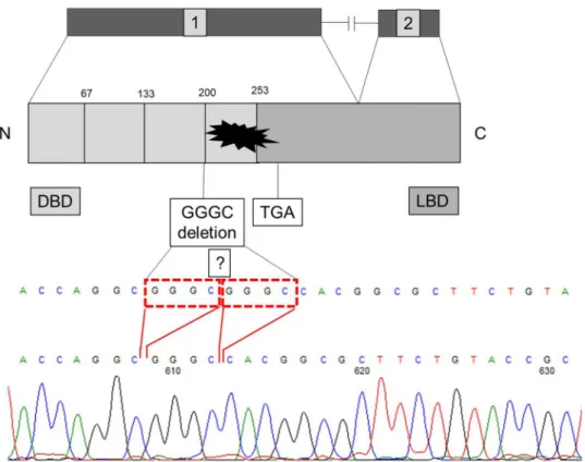 Fig. 1    A novel four nucleotides  deletion del.586-571c.GGGC or  572-575c.GGGC of DAX1 gene  in homozygous form