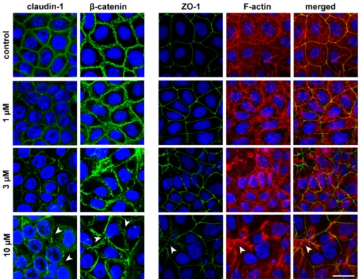 Figure 4. Effects of PN159 peptide on junctional morphology of Caco-2 cells. Immunostaining for  claudin-1, β-catenin and zonula occludens-1 (ZO-1) junctional proteins and fluorescent staining for  F-actin are shown in control conditions or after 1-hour pe