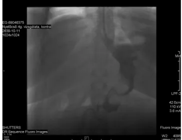 1. ábra Nyelési röntgenvizsgálat a műtétet követő első posztoperatív  napon