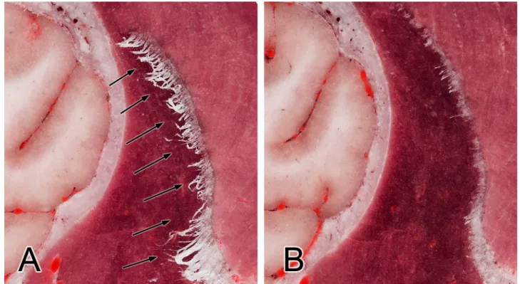 Fig 7. Transverse section at the level of the rostral commissure (A) and at the level of lateral geniculate body (B)