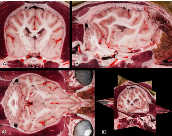 Fig 8. Reconstruction based on the original transverse cryosectioned images. (A) Transverse plane (original image)