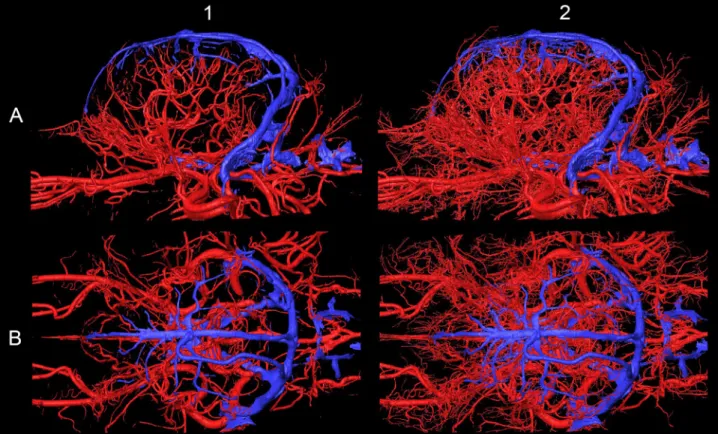 Fig 11. Arteries (in red) and veins (in blue) on the 3D-model with different detailedness