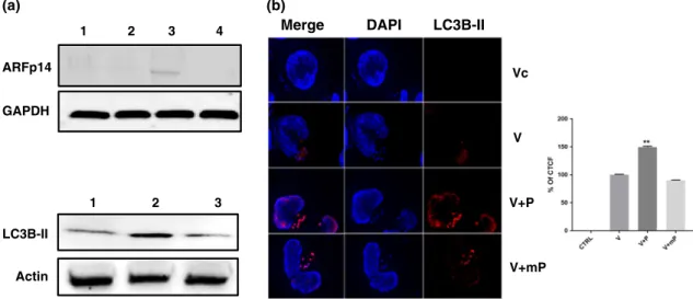 FIGURE 7 Loss of JNK2 provokes appearance of smARF and induction of autophagy. (a) Loss of JNK2 provoked by treating virulent macrophages (Lane 1) with 1 μ M (Lane 2) and 5 μ M (Lane 3) of the penetrating JNK ‐ binding motif peptide causes a dose ‐ depende