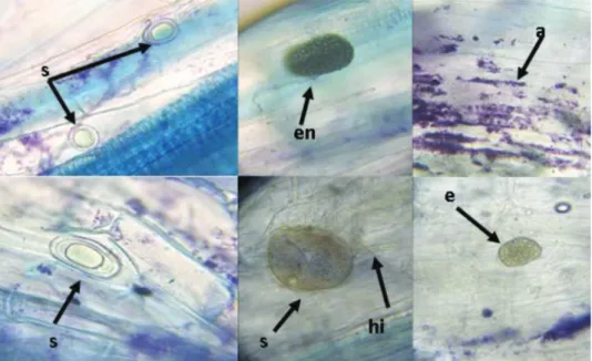 Fig. 1. Crocus sativus roots with arbuscular mycorrhizal structures:  