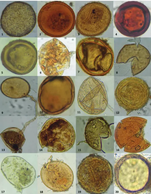 Fig. 2. Endomycorrhizal fungi isolated from the rhizosphere of Crocus sativus