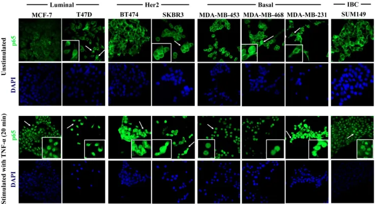 Figure 5. TNF-α-induced activation of the NF-κB pathway in breast cancer cell lines. Cells were cultured under control conditions (upper panel) or after 20 min