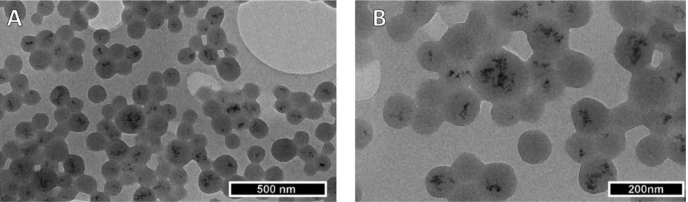 Figure 3: Transmission electron micrograph of targeted theranostic nanocarriers at 10000-fold (A) and 20,000-fold  (B) magnification