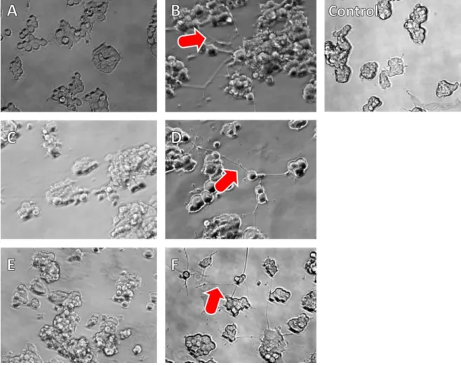 Figure 5: In vitro neurite outgrowth of rat embryonic pheochromocytoma cells (PC12)  after incubation with NGF- NGF-PEG solution (A: 6.25 ng NGF/well, B: 12.5 ng NGF/well), NGF-NGF-PEG lyophilisate solution (C: 6.25 ng NGF/well, D: 