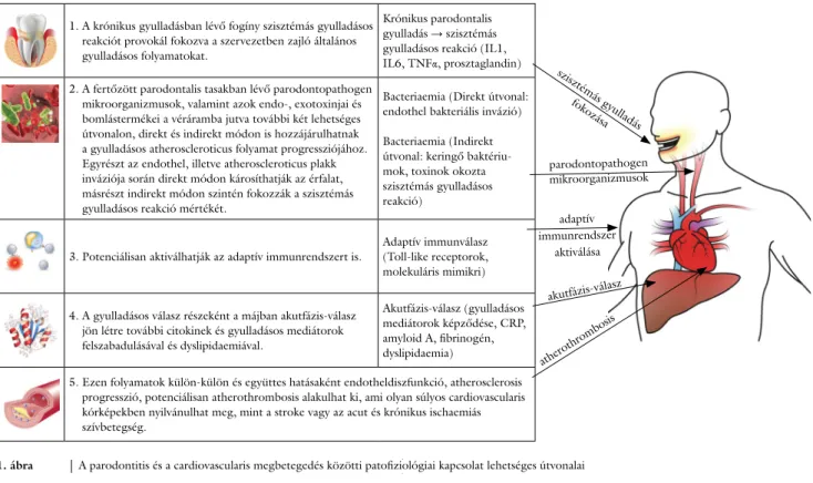 1. ábra A parodontitis és a cardiovascularis megbetegedés közötti patofiziológiai kapcsolat lehetséges útvonalai