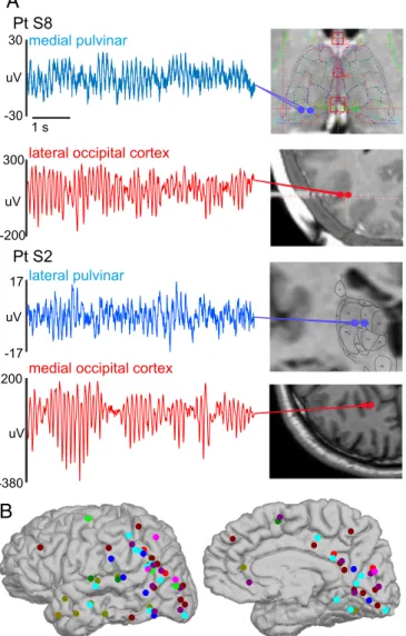 Fig. 3. Robust alpha rhythms can be recorded in human pulvinar and cor- cor-tex. (A) Representative 6-s LFPg traces of simultaneous thalamic and cortical alpha activity