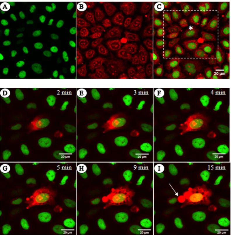 Fig 1. Native chromatin does not readily stain with EBr. (A-C) Live HeLa H3-GFP cells stained with EBr and imaged by CLSM