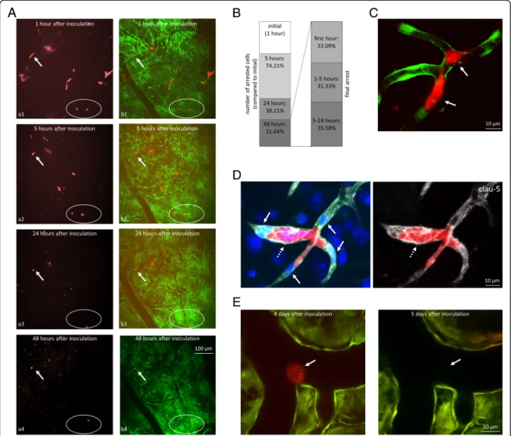 Fig. 1 Arrest of breast cancer cells in the cerebral vasculature. a: Representative two-photon microscopy z-projection images of tdTomato-4T1 cells arrested in the cerebral microvasculature of FVB/Ant:TgCAG-yfp mice
