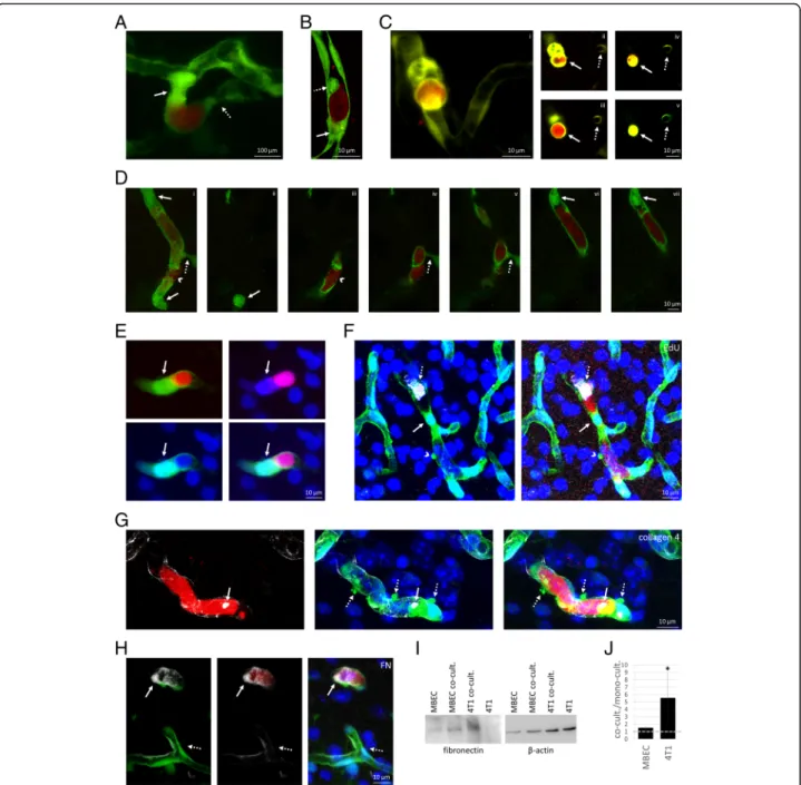 Fig. 2 Vascular changes induced by metastatic cells before extravasation into the brain parenchyma