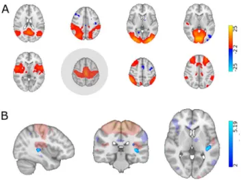 Fig. 2    Group independent component analysis and dual regression  results. A The group ICA analysis produced 8 components  resem-bling previously described resting state networks (from left-to-right): 