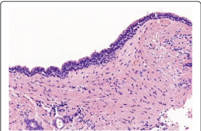 Fig. 3 Histologic finding. A hematoxylin-eosin (H&amp;E) stained slide demonstrates the cyst lining, which is comprised of a ciliated pseudostratified columnar epithelium without atypia