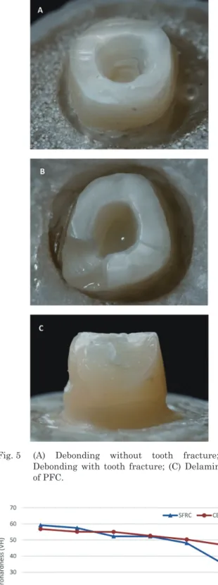 Fig. 5  (A)  Debonding  without  tooth  fracture;  (B)  Debonding  with  tooth  fracture;  (C)  Delamination  of PFC.