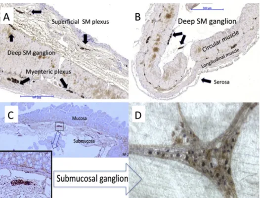 Fig. 2 Ileal flap. A: In Group I, all plexuses, the superficial and deep submucosal and the myenteric plexuses were intact (Conventional section, Neurofilament immunostaining); B: In Group II, only 1 e 2 submucosal ganglia were attached loosely to the sero