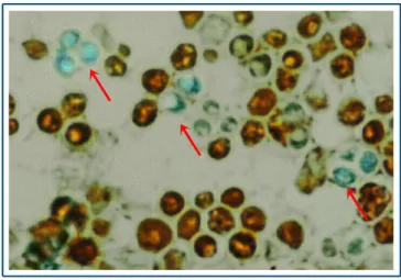 Figure 1. Saccharomyces cerevisiae cells and ascopores. 
