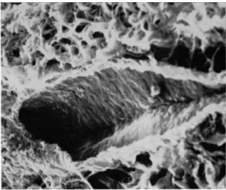 FIG. 12. Scanning electron micrograph of two small arterioles originally  identified by comparison with their appearance under the light microscope and  the circumferential layering of the vessel walls