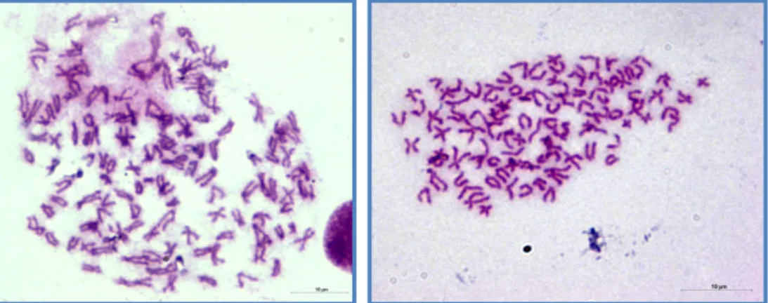 1. és 2. ábra: 3n=150 kromoszómaszámú (hexaploid) és 2n=100 kromoszómaszámú (tetraploid) réticsík  ivadék kromoszómakészlete. 